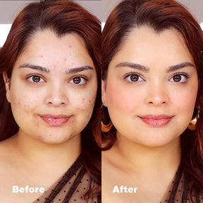 Universal Foundation Vorher-Nachher-Vergleich zur Abdeckung von Akne und Rötungen für ein natürliches mattes Finish