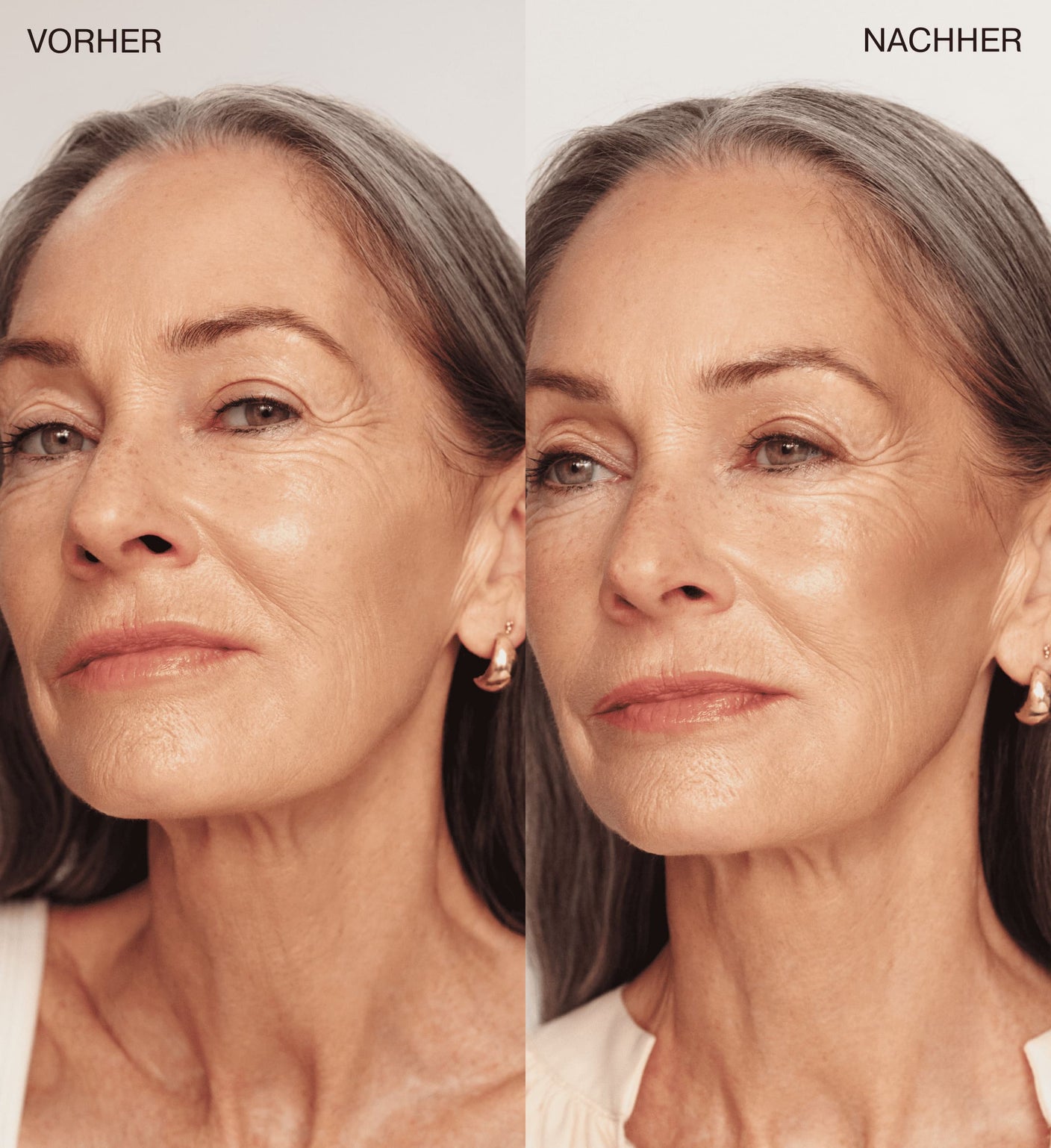 Vorher-Nachher: Reife Haut mit The Valentines Bundle und The Soft Tan Bronzer für einen natürlichen Sommer-Glow.