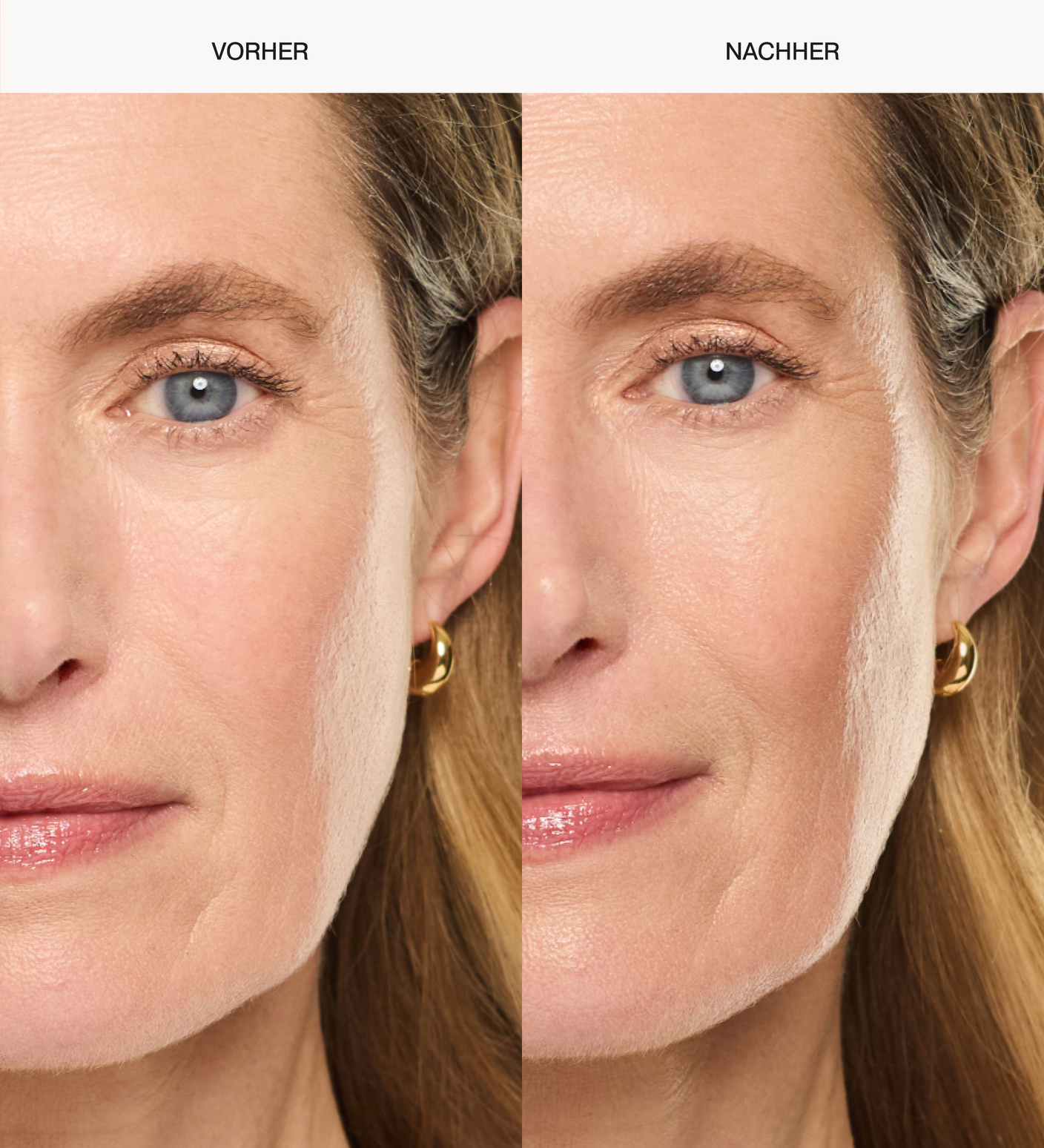Vorher-Nachher-Vergleich mit Daily Face SPF 40 für hydratisierte Haut und ein natürliches, strahlendes Finish.